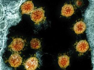Partikel des Coronavirus SARS-CoV-2 wurden für eine elektronenmikroskopische Aufnahme am «National Institute of Allergy and Infectious Diseases Integrated Research Facility» farblich bearbeitet. 