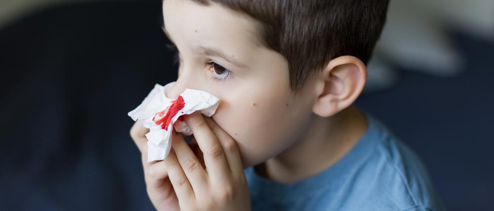 Ein kleiner Junge hält sich ein Taschentuch vor die blutende Nase.