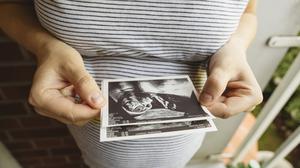 Frau mit Ultraschallbild