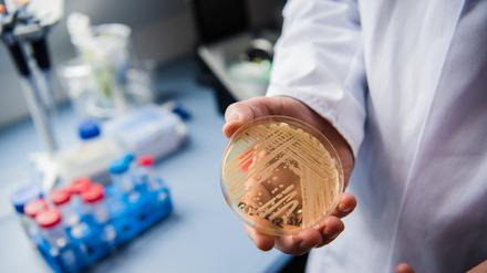 Eine Petrischale mit dem Hefepilz Candida auris.