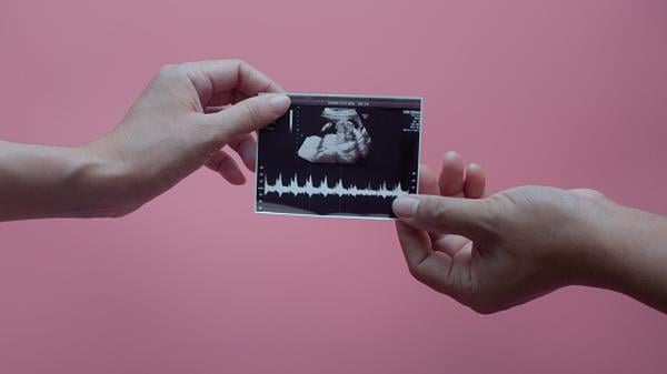 Zwei Hände halten ein Ultraschallbild, auf dem ein Baby zu erkennen ist.