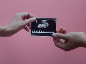 Zwei Hände halten ein Ultraschallbild, auf dem ein Baby zu erkennen ist.