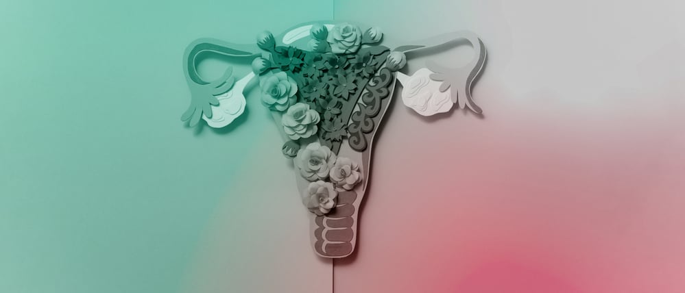 Darstellung eines von Endometriose betroffenen Uterus