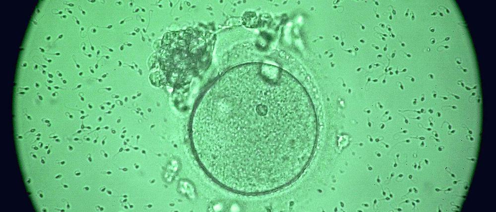 Umstritten. Sobald Ei- und Samenzelle verschmelzen, gilt nach dem Urteil des Europäischen Gerichtshofes für den Embryo die Menschenwürde.