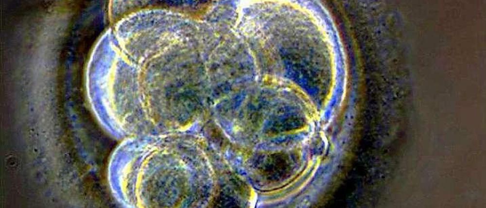 Wenn dem frühen Stadium eines Embryos, der aufgrund eines Gendefekts keine Niere bilden kann, genetisch intakte Stammzellen untergeschoben werden, dann können die Stammzellen dieses Organ bilden. So könnten in Tieren Organe aus menschlichen Zellen gezüchtet werden.