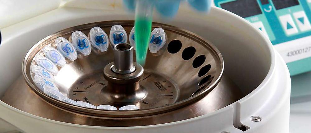 Positive Proben. In Labors werden Sprossen aus Bienenbüttel auf Ehec getestet.