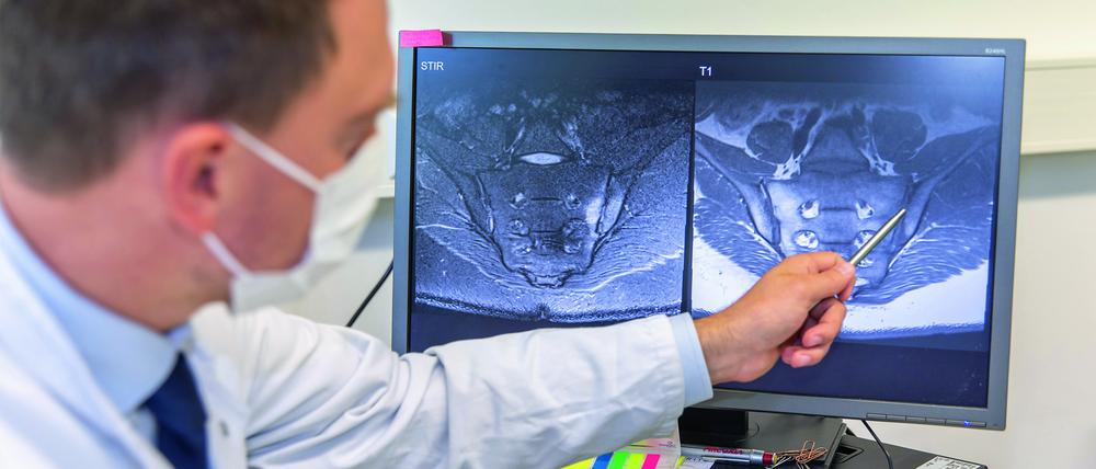 Rheumatologe Denis Poddubnyy zeigt anhand eines MRT-Bildes die in der Wirbelsäule betroffenen Stellen