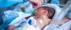 Weltweit werden jedes Jahr fast 13 Millionen Babys zu früh geboren.