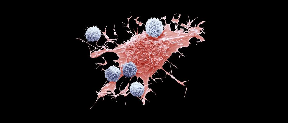 Normalerweise halten Immunzellen (blau) Krebs (rot) in Schach, doch mitunter fördern sie die Bildung von Tochtergeschwulsten.