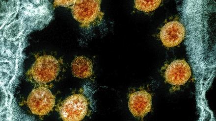 Partikel des Coronavirus SARS-CoV-2 wurden für eine elektronenmikroskopische Aufnahme am «National Institute of Allergy and Infectious Diseases Integrated Research Facility» farblich bearbeitet. 