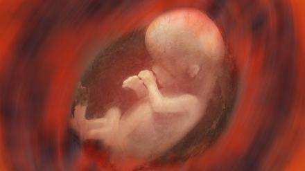 Internal view of a human fetus - approx. 10 weeks , 10483250.jpg, baby, birth, child, embryo, embryonic, fetus, foetus, gynecological, gynecology, human, internal, medical, medicine, prenatal, reproduction, reproductive, scope, unborn, pregnant, pregnancy, uterus, womb,