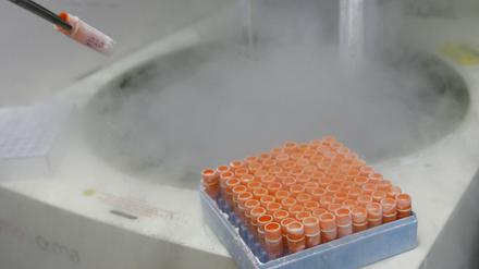 Tiefgefrorene embryonale Stammzellen. Archivbild von 2008.