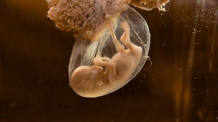 Menschlicher Embryo in Fruchtwasser-gefüllter Fruchtblase