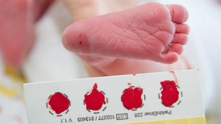 Das Blut für ein Neugeborenen-Screening wird bei den Babys meist am Fuß abgenommen. 