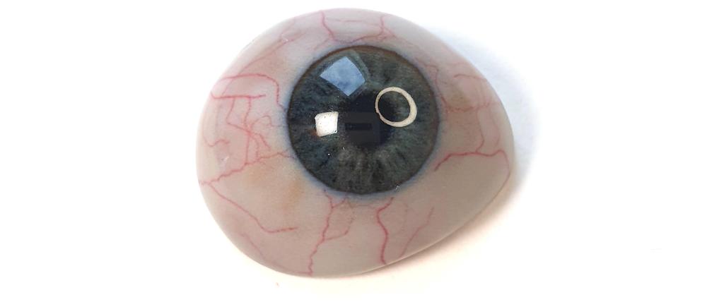3D-gedruckte Augenprothese. 