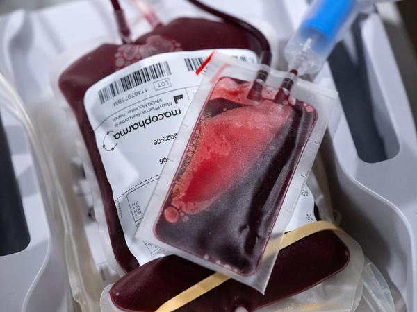 Der Weltblutspendetag am 14.06.2023 ehrt freiwillige Spender, die unentgeltlich Blut spenden und damit anderen Menschen das Leben retten. 
