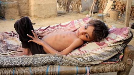 Immer mehr Menschen im Jemen - wie hier in der Provinz Hajjah - leiden an Unterernährung.
