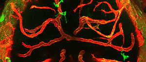 Interaktionen zwischen Makrophagen/Mikroglia (grün) und Hirngefäßen (rot) führen bei Zebrafischen zu Gefäßrückbildung und Zelltod im Gehirn. 