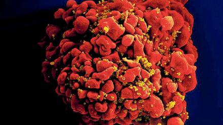 Eine von Immunschwächeviren (senffarben) infizierte T-Zelle (rot). 