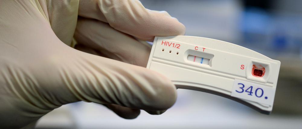 HIV-Tests gehören zu den Laborverfahren, die vor einem Ansatz vergleichsweise streng überprüft werden. Bei anderen Blutuntersuchungsverfahren sind die Leistungstests vor der Markteinführung weniger penibel.