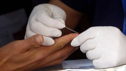 HIV-Test in Chile. 