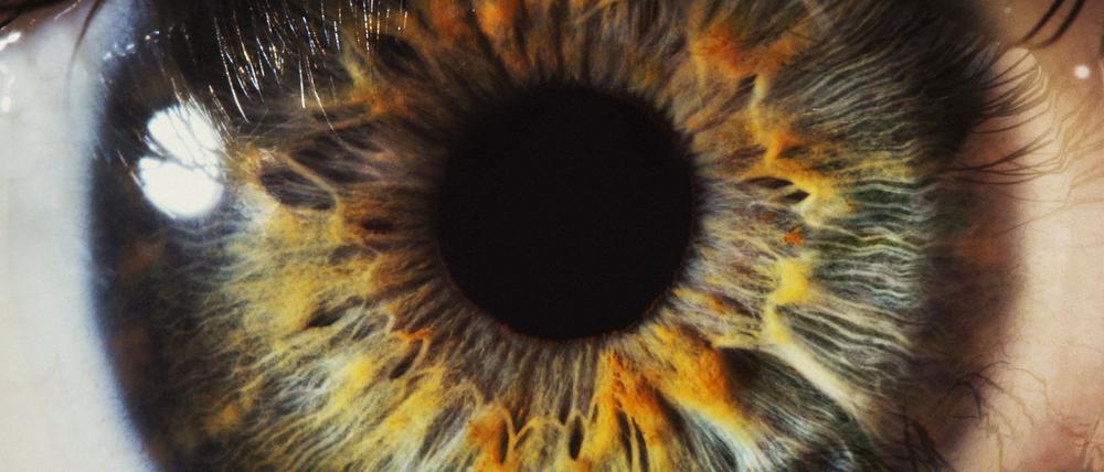 In Deutschland sind über 900.000 Menschen vom Grünen Star betroffen.