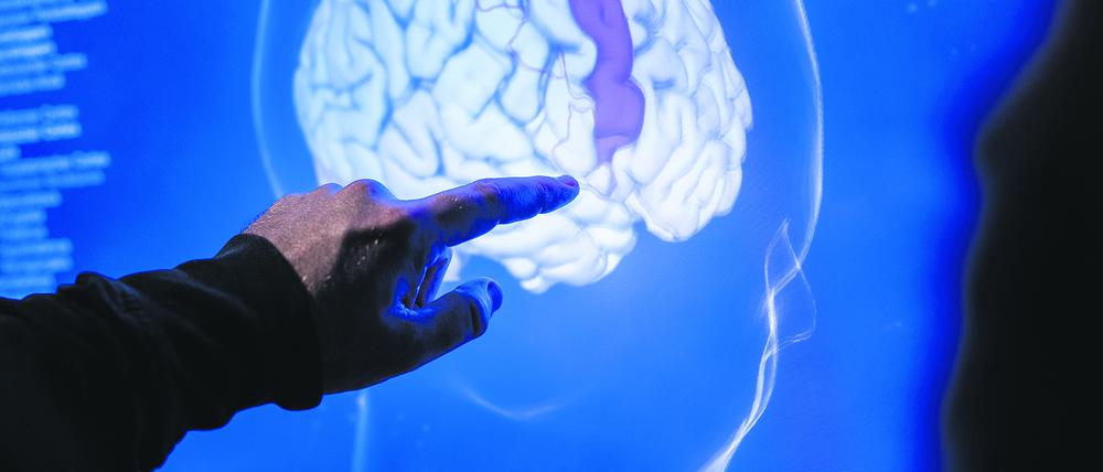 Der Exzellenzcluster „NeuroCure“ verbindet Grundlagenforschung und klinische Praxis.