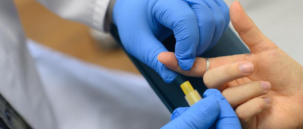 Per Bluttest kann eine HIV-Infektion nachgewiesen werden.
