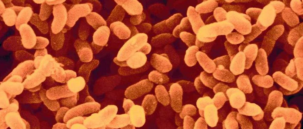 Keimende Gefahr. Bakterien wie diese Kolonie Klebsiella pneumoniae sind immer häufiger gegen fast alle Antibiotika resistent.