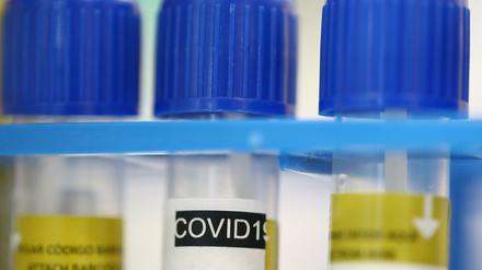 Symbolbild: Im Labor.