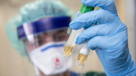 Derzeit sind 204 Menschen in Potsdam-Mittelmark akut an Covid-19 erkrankt (Symbolbild).