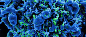 Am Ende des Vermehrungszyklus in einer infizierten Zelle (blau) schnüren sich neue Virenpartikel von der Zelloberfläche ab.