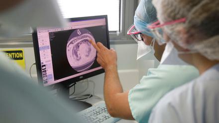Straßburg: Medizinisches Personal bespricht ein Röntgenbild der Lunge eines Corona-Patienten im Nouvel Hopital Civil.