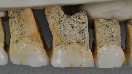 Auch die Zähne von Homo luzonensis haben einen Mix archaischer, Australophitecus-ähnlicher und dem modernen Menschen, Homo sapiens, gleichende Merkmale.