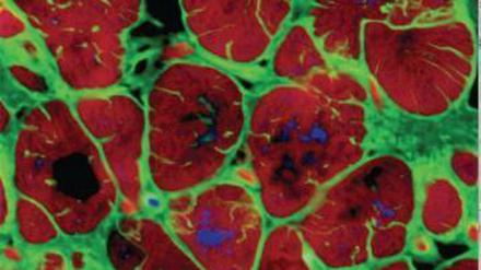 Bestimmte Zellen aus der Plazenta können sich in Herzmuskelzellen verwandeln und beschädigte Regionen von Herzen nach einem Infarkt reparieren - zumindest bei Mäusen. 