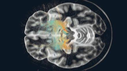 Blick ins menschliche Gehirn: Neurologische und psychiatrische Erkrankungen können viele Ursachen haben. 