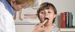 Mandelinfekte sind bei Kindern häufig, Mandel-OPs auch. Werden die Organe früh entfernt, könnte das Auswirkungen auf die spätere Gesundheit haben.